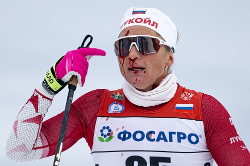 Кубок России. Женщины. 10 км свободным стилем